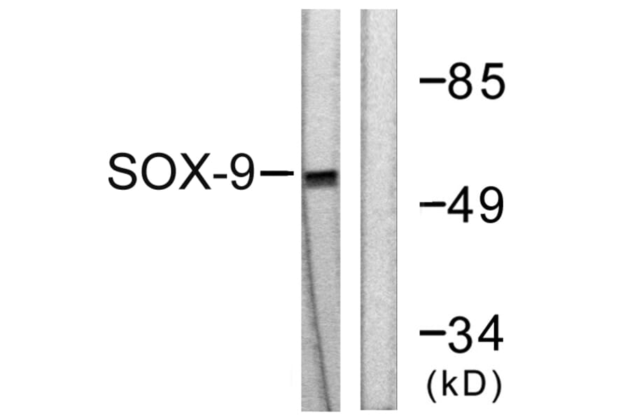 Western Blot - Anti-SOX9 Antibody (B0576) - Antibodies.com