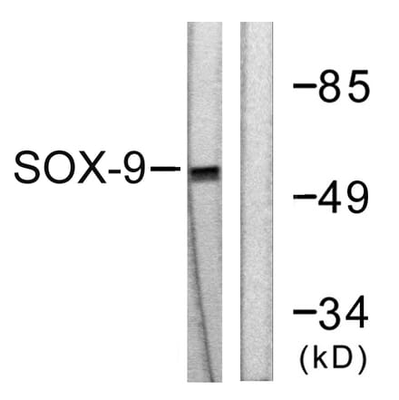 Western Blot - Anti-SOX9 Antibody (B0576) - Antibodies.com