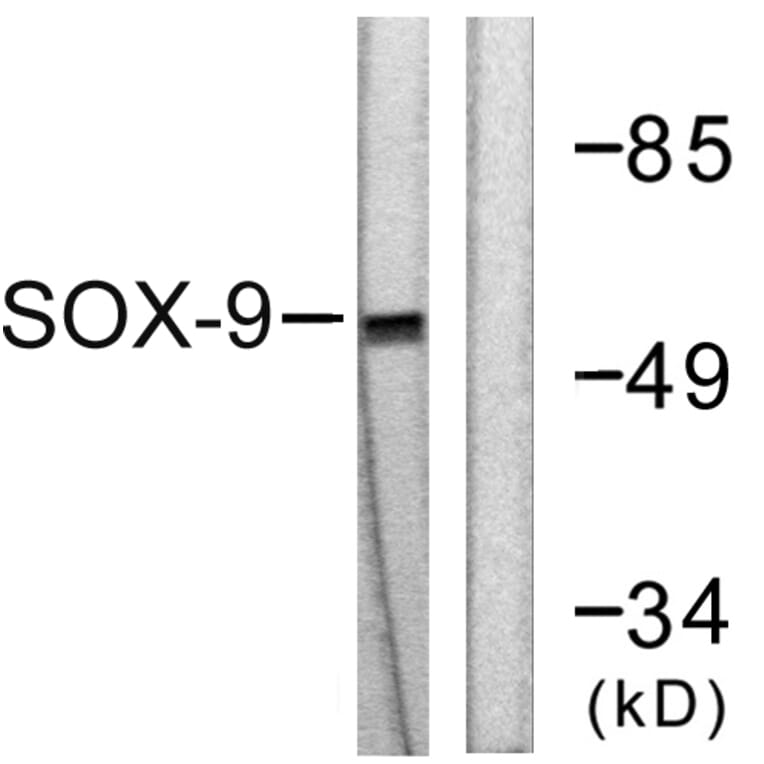 Western Blot - Anti-SOX9 Antibody (B0576) - Antibodies.com