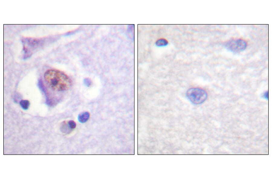 Immunohistochemistry - Anti-SOX9 Antibody (B0576) - Antibodies.com