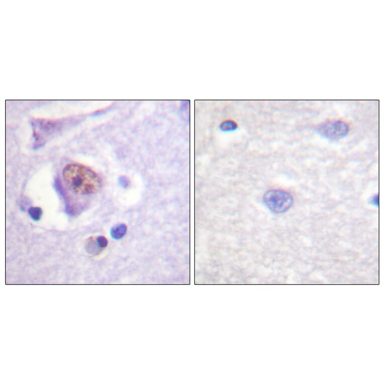 Immunohistochemistry - Anti-SOX9 Antibody (B0576) - Antibodies.com