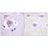Immunohistochemistry - Anti-SOX9 Antibody (B0576) - Antibodies.com