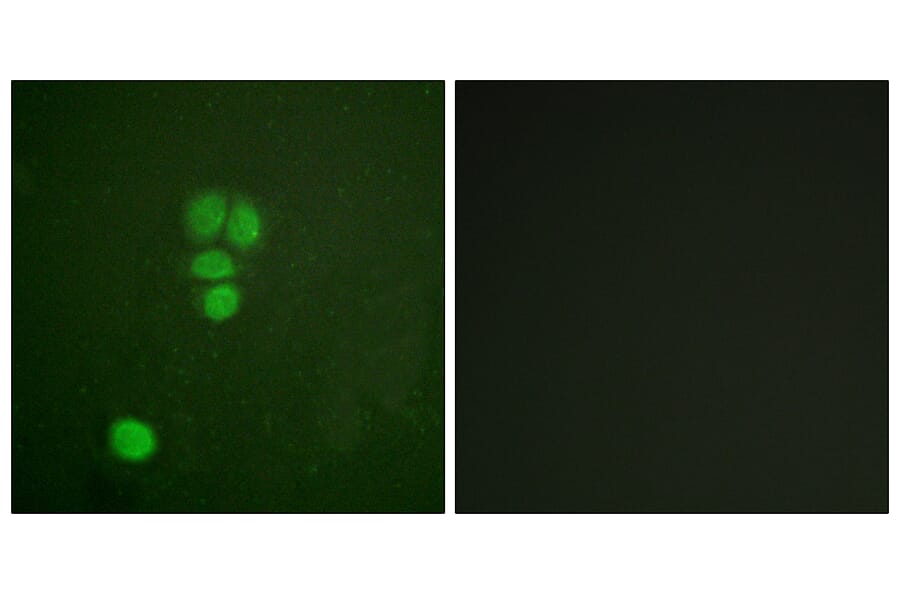 Immunofluorescence - Anti-SOX9 Antibody (B0576) - Antibodies.com