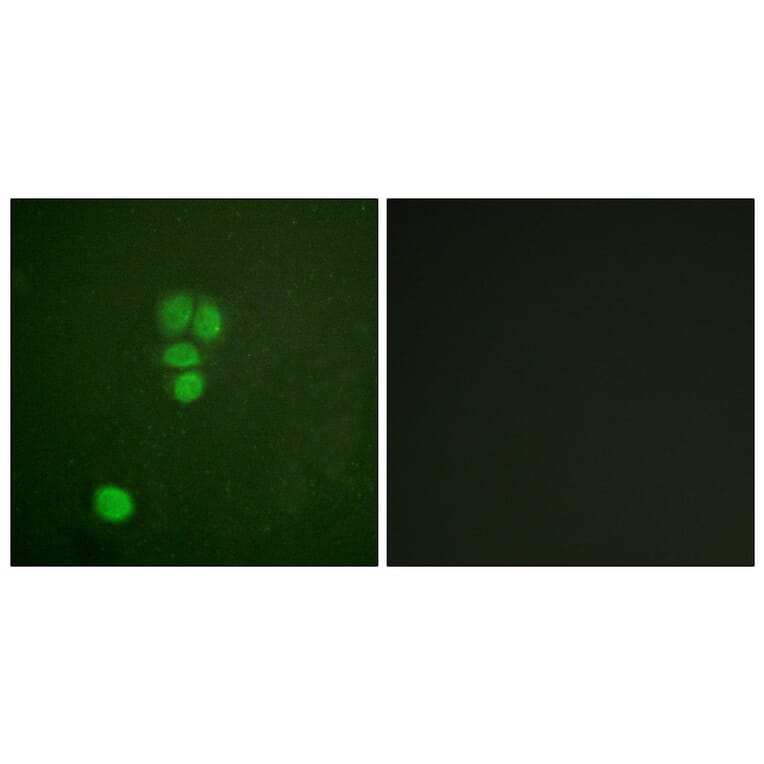 Immunofluorescence - Anti-SOX9 Antibody (B0576) - Antibodies.com