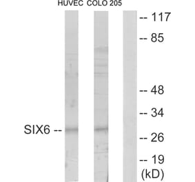 Western Blot - Anti-SIX6 Antibody (C10233) - Antibodies.com