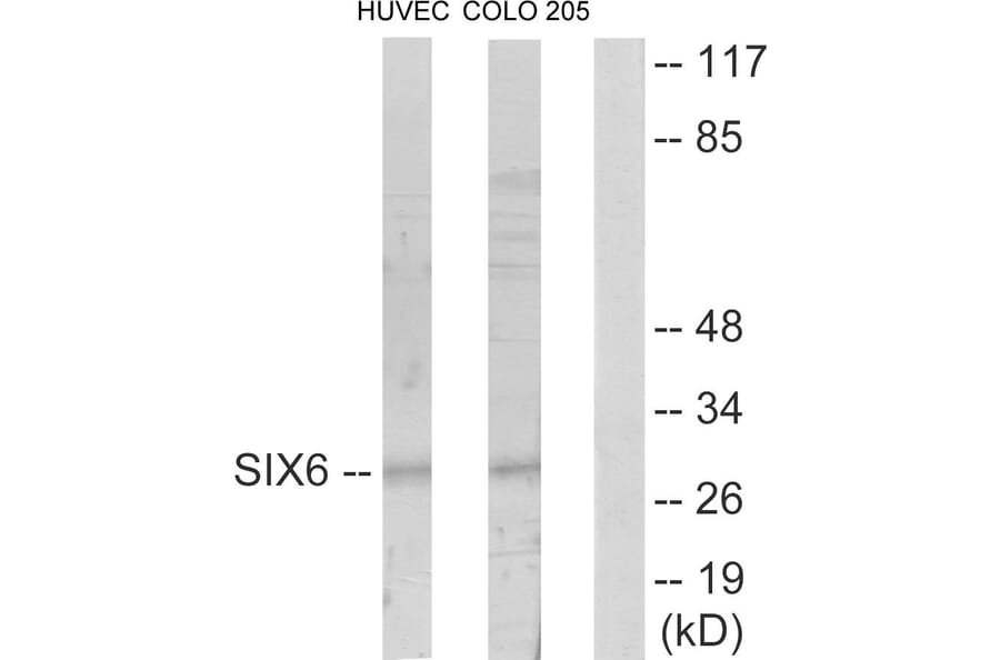Western Blot - Anti-SIX6 Antibody (C10233) - Antibodies.com