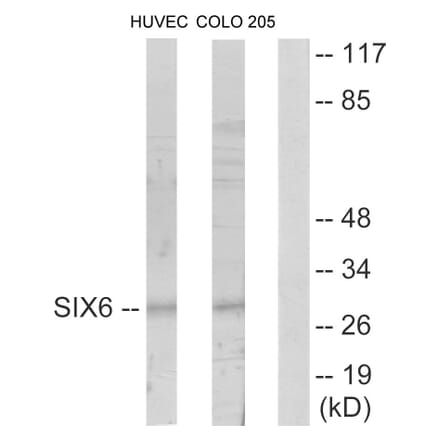 Western Blot - Anti-SIX6 Antibody (C10233) - Antibodies.com