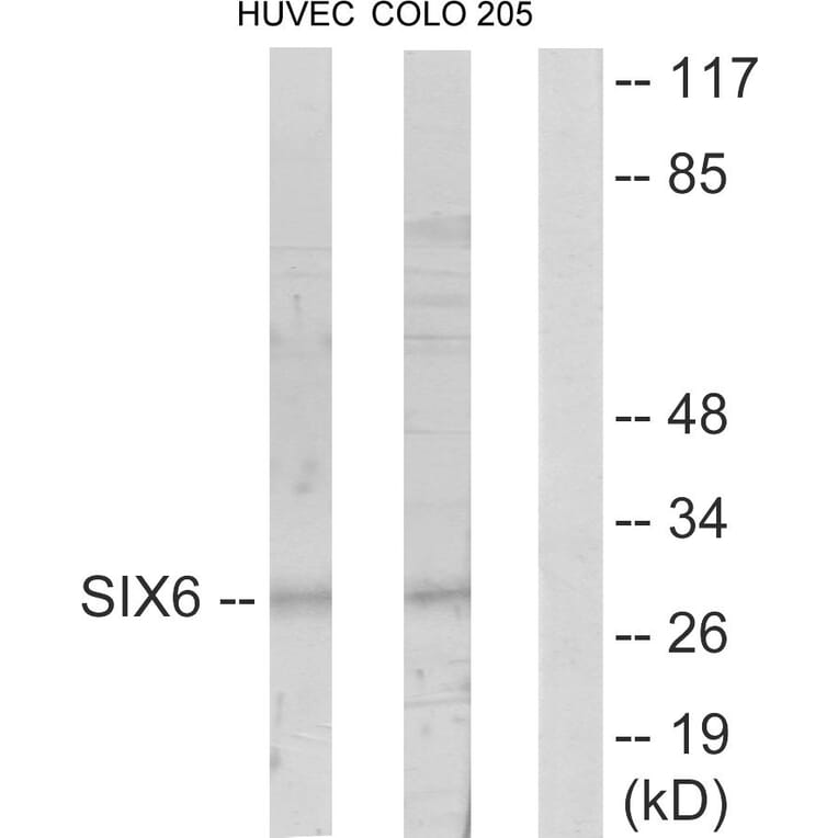 Western Blot - Anti-SIX6 Antibody (C10233) - Antibodies.com