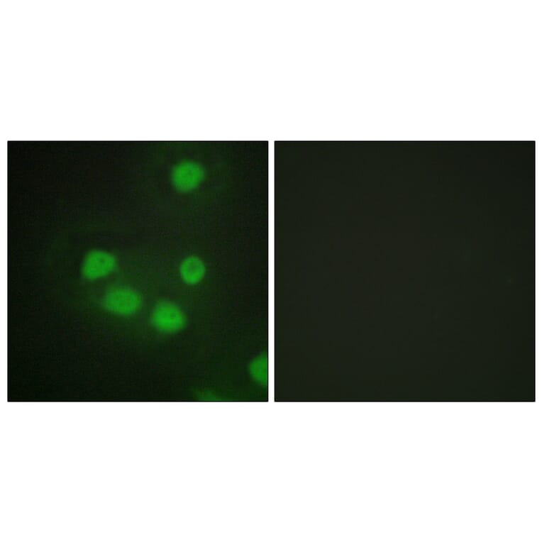 Immunofluorescence - Anti-SIX6 Antibody (C10233) - Antibodies.com