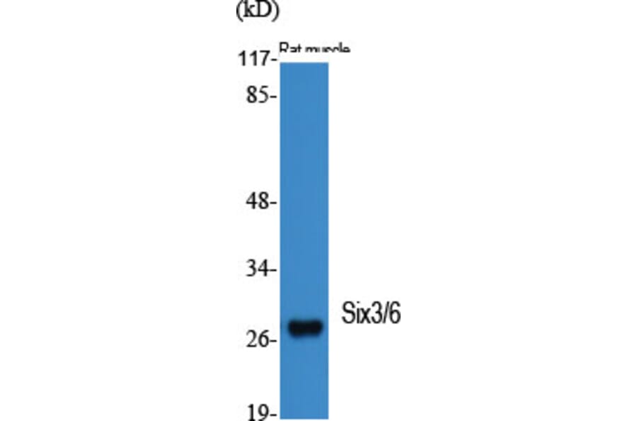 Western Blot - Anti-SIX6 Antibody (C10233) - Antibodies.com