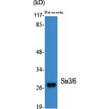 Western Blot - Anti-SIX6 Antibody (C10233) - Antibodies.com