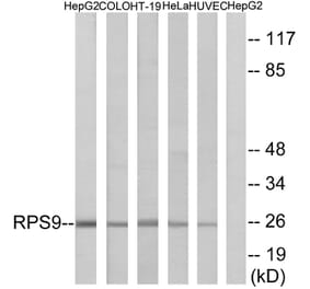 Western Blot - Anti-RPS9 Antibody (C14127) - Antibodies.com