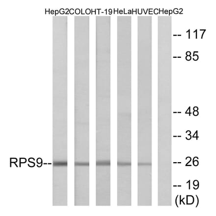 Western Blot - Anti-RPS9 Antibody (C14127) - Antibodies.com