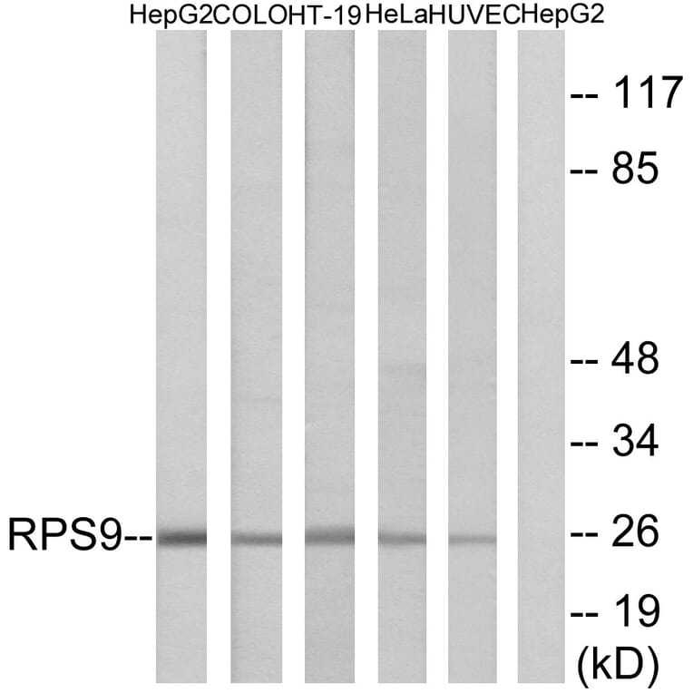 Western Blot - Anti-RPS9 Antibody (C14127) - Antibodies.com