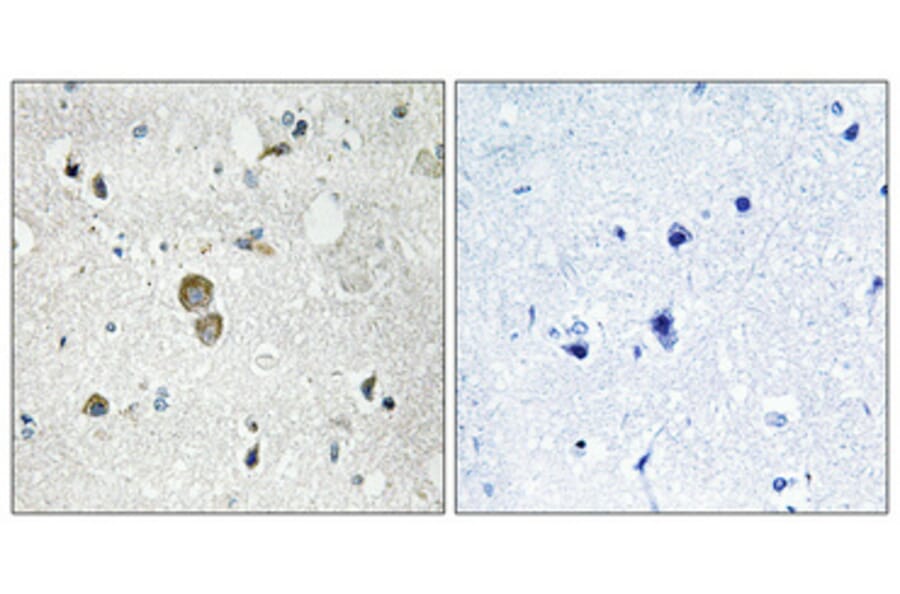Immunohistochemistry - Anti-RPS9 Antibody (C14127) - Antibodies.com