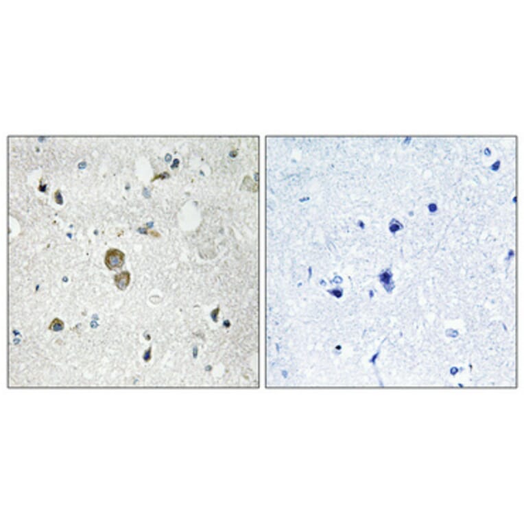 Immunohistochemistry - Anti-RPS9 Antibody (C14127) - Antibodies.com