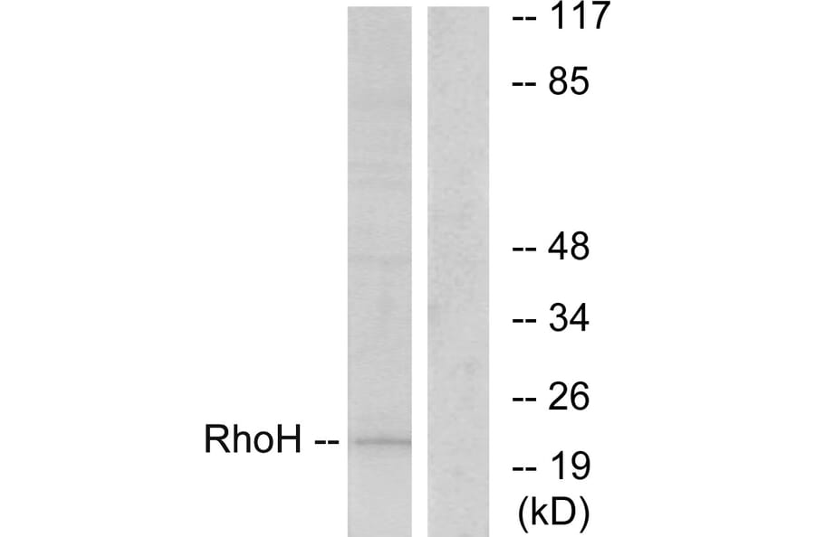 Western Blot - Anti-RhoH Antibody (C11096) - Antibodies.com