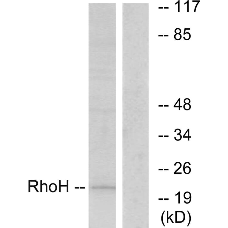 Western Blot - Anti-RhoH Antibody (C11096) - Antibodies.com