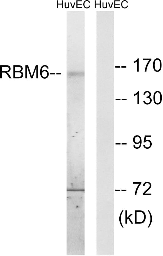 Western blot analysis of lysates from HUVEC cells using Anti-RBM6 Antibody. The right hand lane represents a negative control, where the antibody is blocked by the immunising peptide.