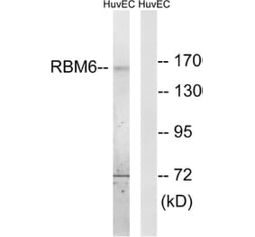 Western Blot - Anti-RBM6 Antibody (C10790) - Antibodies.com