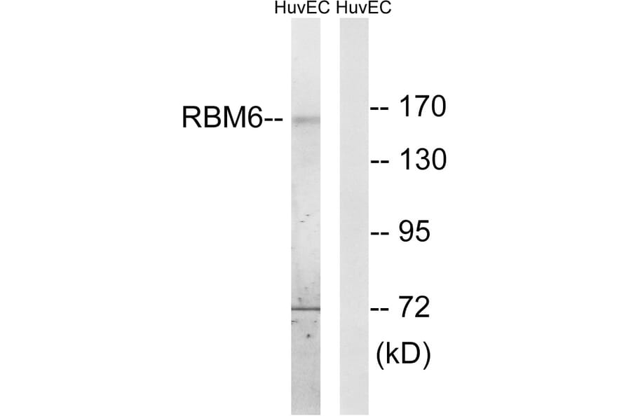 Western Blot - Anti-RBM6 Antibody (C10790) - Antibodies.com