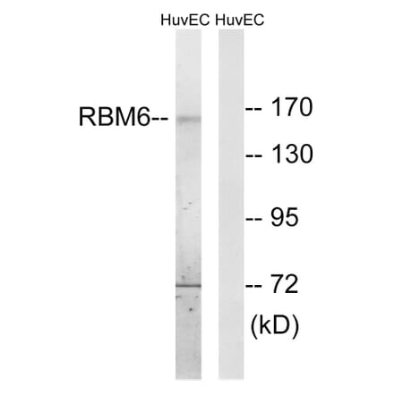 Western Blot - Anti-RBM6 Antibody (C10790) - Antibodies.com