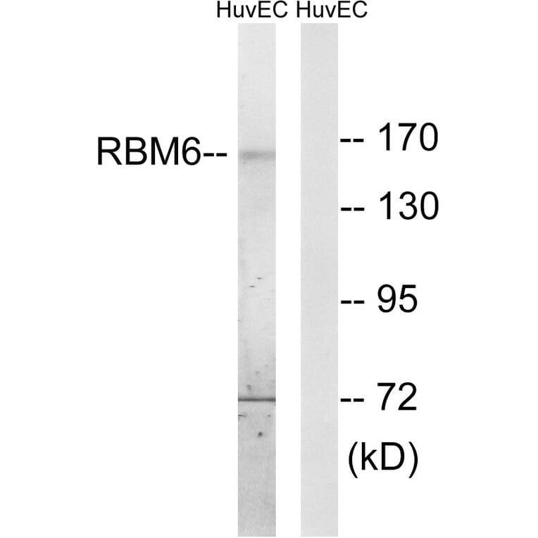 Western Blot - Anti-RBM6 Antibody (C10790) - Antibodies.com