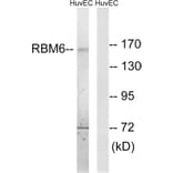 Western Blot - Anti-RBM6 Antibody (C10790) - Antibodies.com
