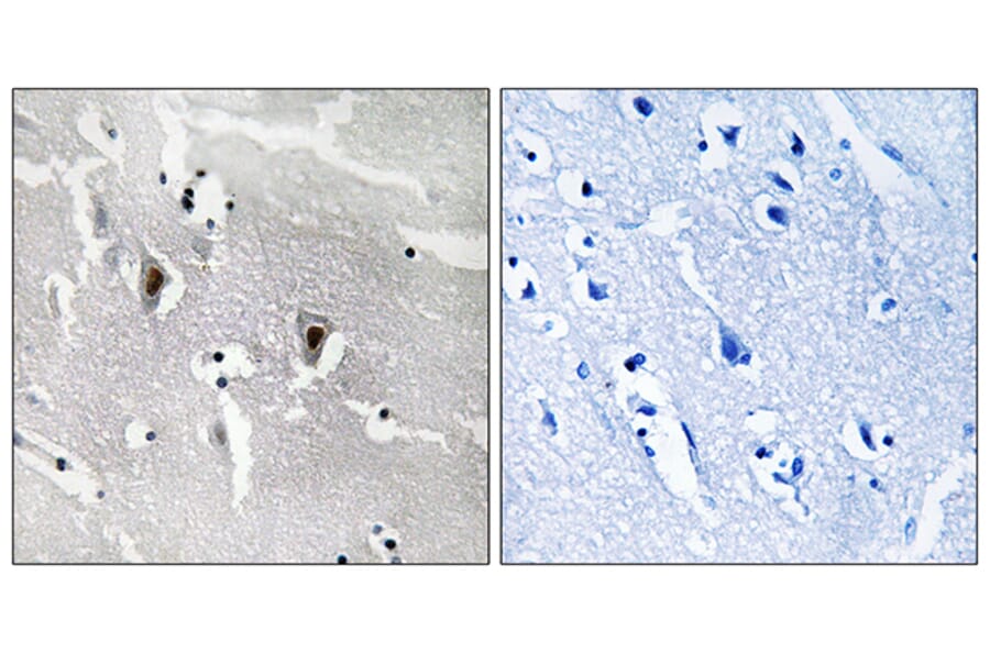 Immunohistochemistry - Anti-RBM6 Antibody (C10790) - Antibodies.com