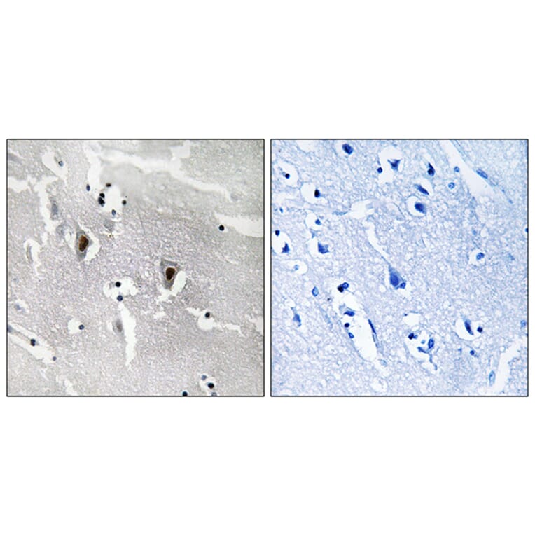 Immunohistochemistry - Anti-RBM6 Antibody (C10790) - Antibodies.com