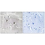 Immunohistochemistry - Anti-RBM6 Antibody (C10790) - Antibodies.com