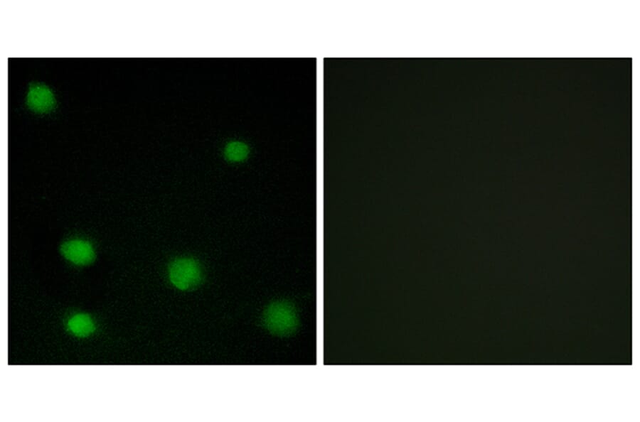 Immunofluorescence - Anti-RBM6 Antibody (C10790) - Antibodies.com