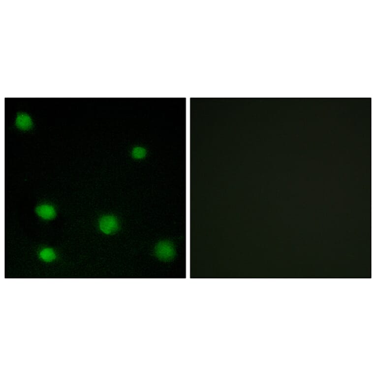 Immunofluorescence - Anti-RBM6 Antibody (C10790) - Antibodies.com