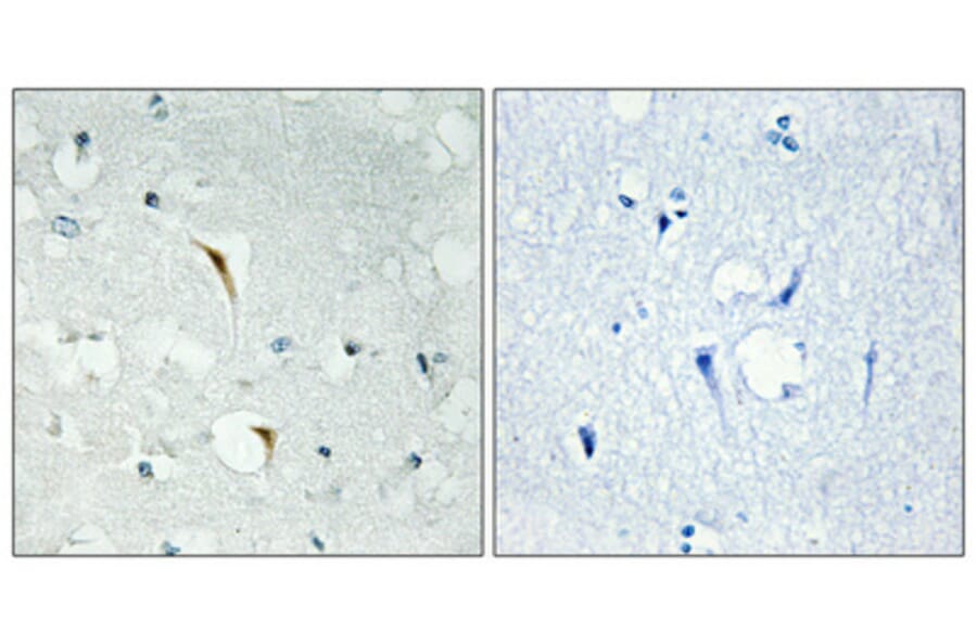 Immunohistochemistry - Anti-RBM6 Antibody (C10790) - Antibodies.com