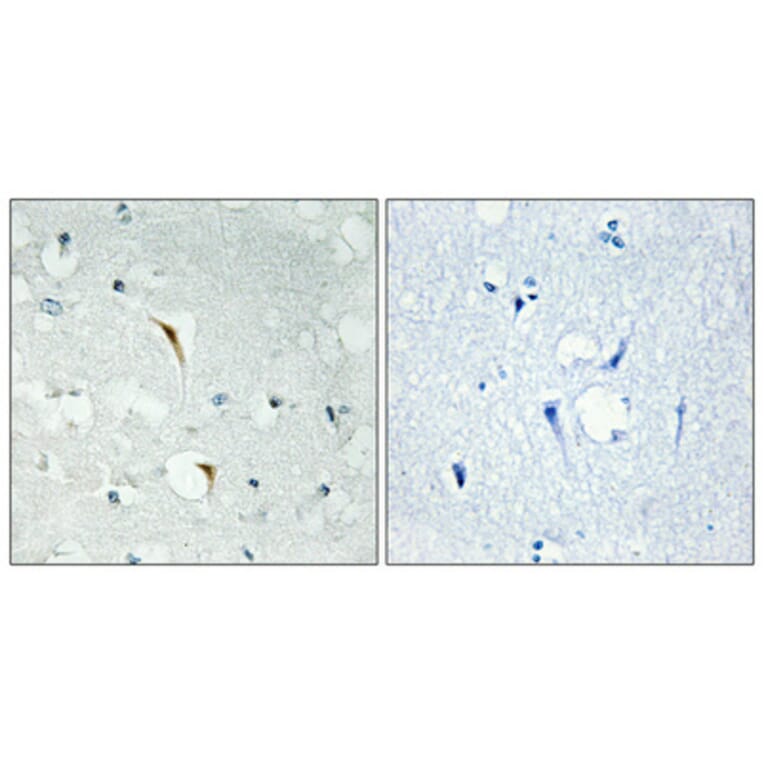 Immunohistochemistry - Anti-RBM6 Antibody (C10790) - Antibodies.com