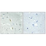 Immunohistochemistry - Anti-RBM6 Antibody (C10790) - Antibodies.com