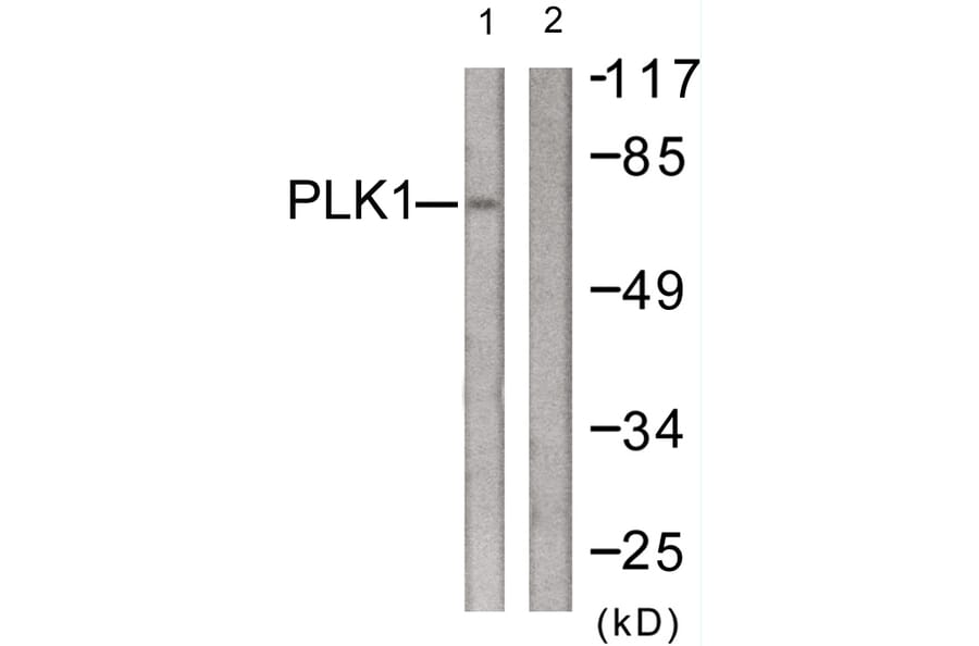 Western Blot - Anti-PLK1 Antibody (B0554) - Antibodies.com