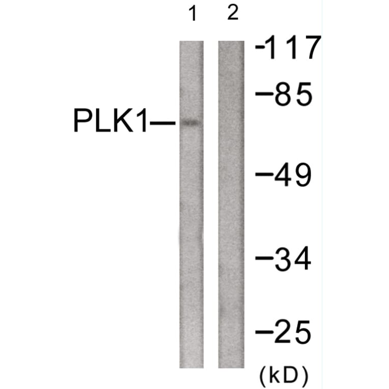 Western Blot - Anti-PLK1 Antibody (B0554) - Antibodies.com