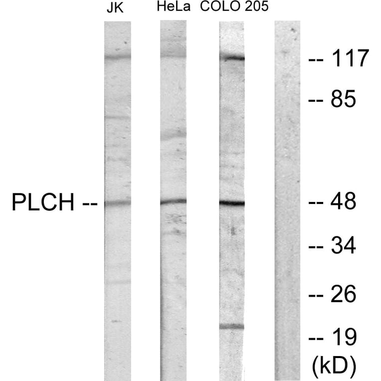Western Blot - Anti-PLCH Antibody (C11166) - Antibodies.com