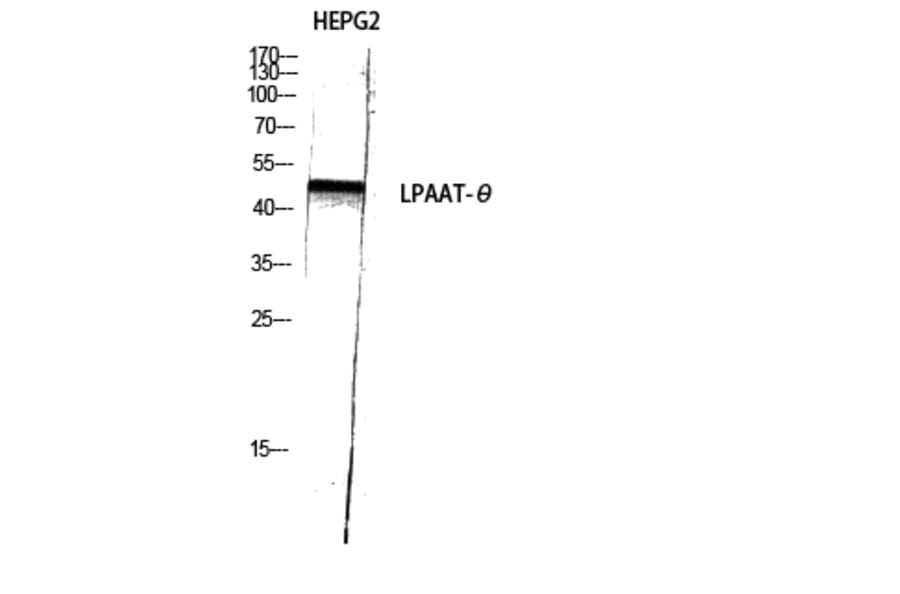 Western Blot - Anti-PLCH Antibody (C11166) - Antibodies.com