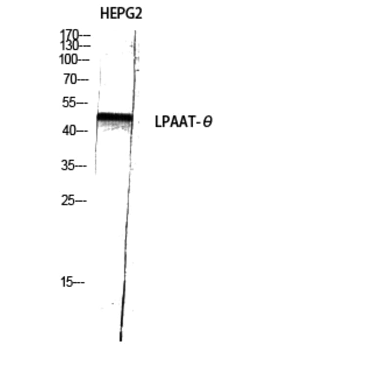 Western Blot - Anti-PLCH Antibody (C11166) - Antibodies.com