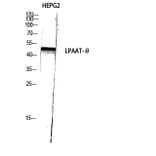 Western Blot - Anti-PLCH Antibody (C11166) - Antibodies.com