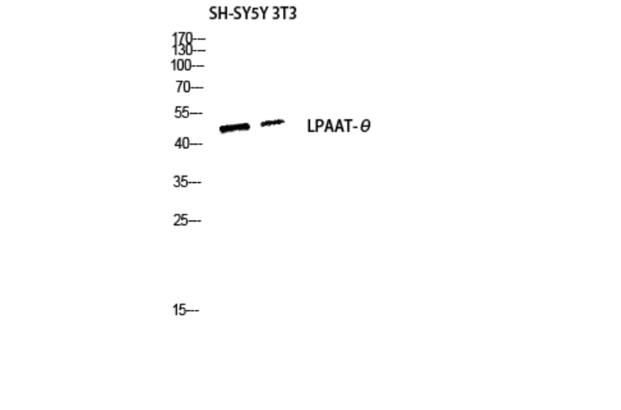 Western Blot - Anti-PLCH Antibody (C11166) - Antibodies.com
