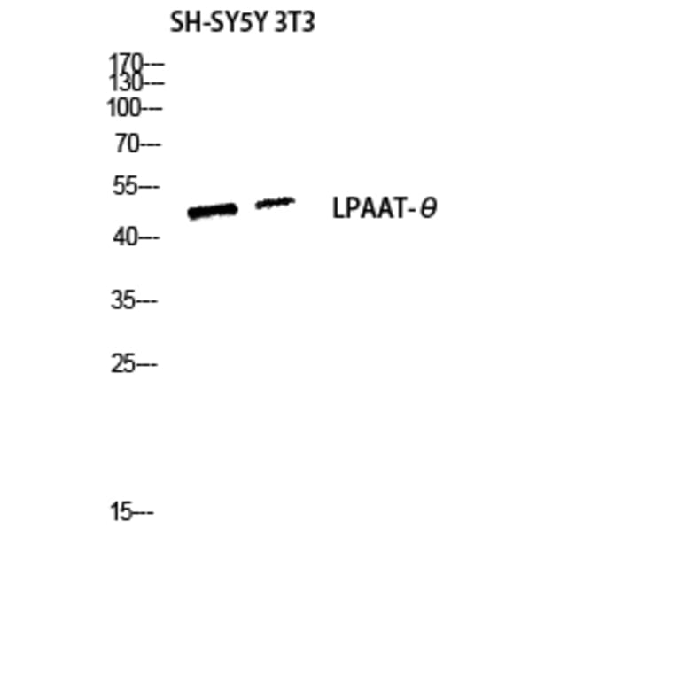 Western Blot - Anti-PLCH Antibody (C11166) - Antibodies.com