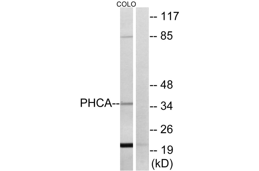Western Blot - Anti-PHCA Antibody (C14411) - Antibodies.com