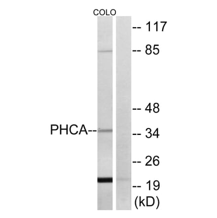 Western Blot - Anti-PHCA Antibody (C14411) - Antibodies.com