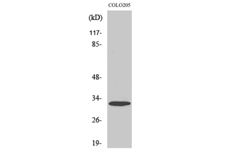 Western Blot - Anti-PHCA Antibody (C14411) - Antibodies.com