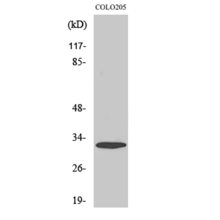 Western Blot - Anti-PHCA Antibody (C14411) - Antibodies.com