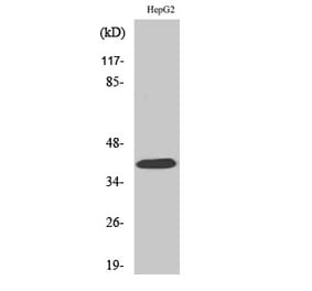 Western Blot - Anti-PAR4 Antibody (G939) - Antibodies.com