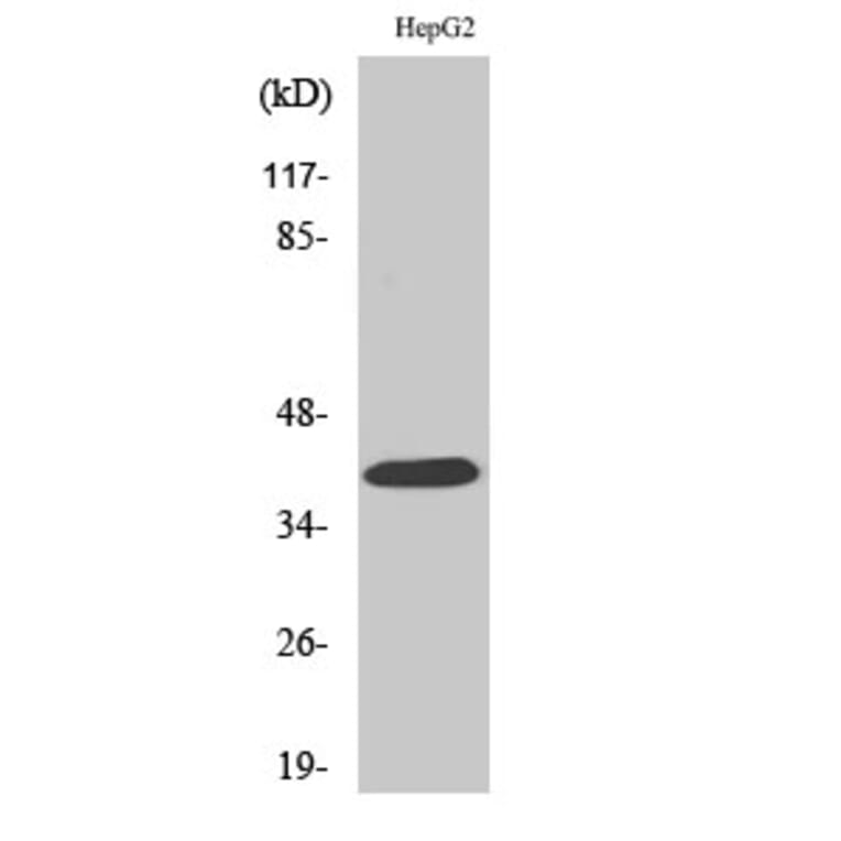 Western Blot - Anti-PAR4 Antibody (G939) - Antibodies.com